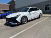 Hyundai Elantra N Performance Intercooler - Image 4